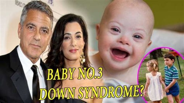 Exploring The Truth: Does One Of George Clooney's Children Have Down Syndrome?