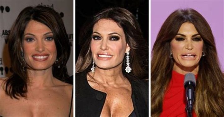 Kimberly Guilfoyle Plastic Surgery Transformation: Before And After