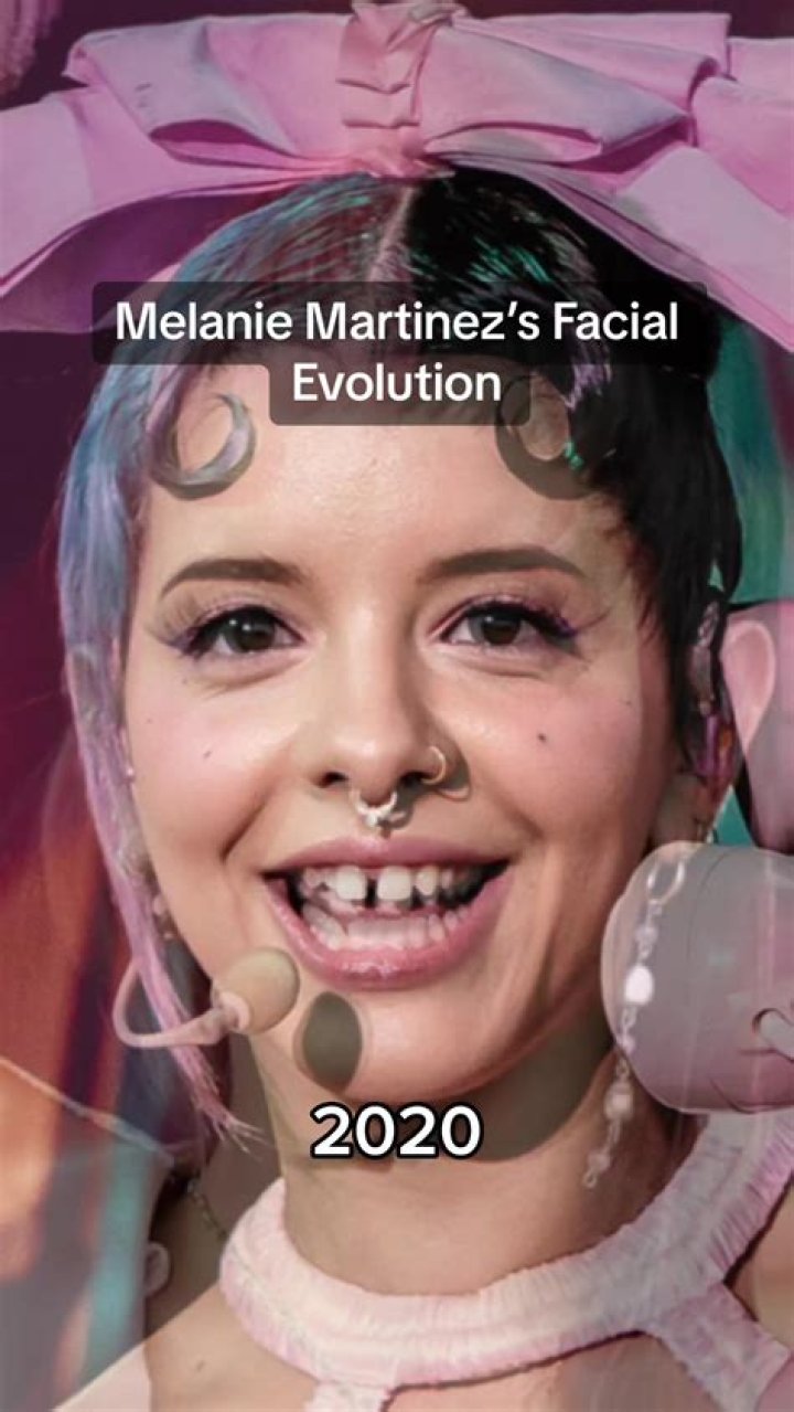 Melanie Martinez: Unveiling The Unique Identity Of Her Fans