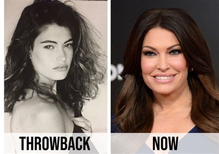 Transformation And Controversy: Kimberly Guilfoyle After Plastic Surgery