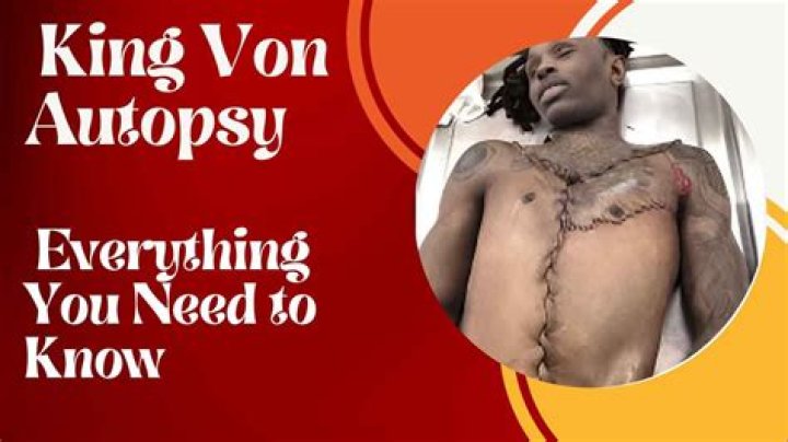 Unraveling The Mystery Behind King Von Leaked