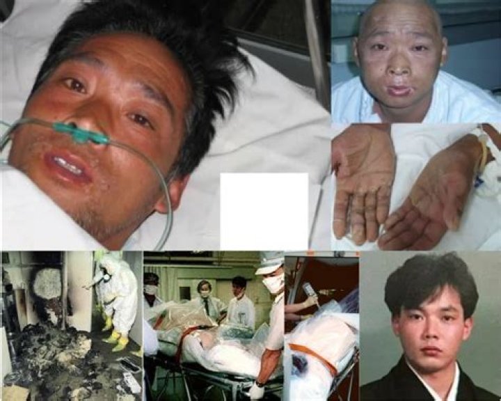 Unseen Images: Hisashi Ouchi's Tragic Injuries Revealed