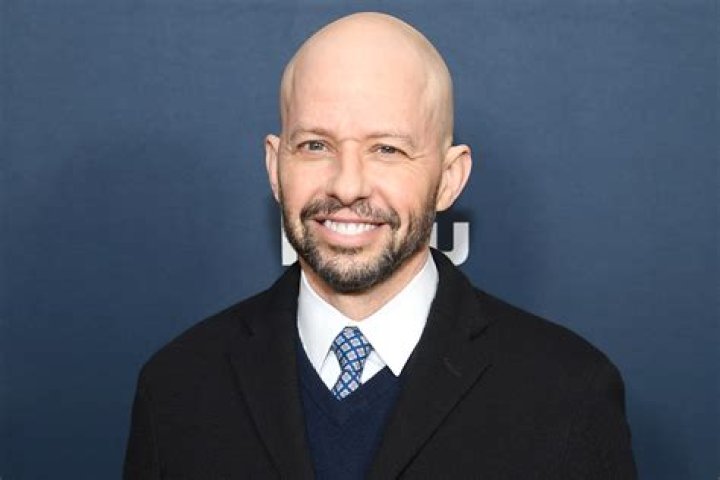 Unveiling Jon Cryer's Hair Loss Journey: Insights And Revelations